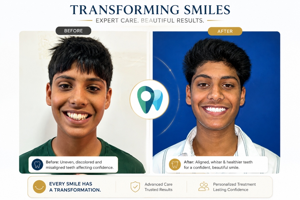 Orthodontic & Whitening Before After Smile Transformation